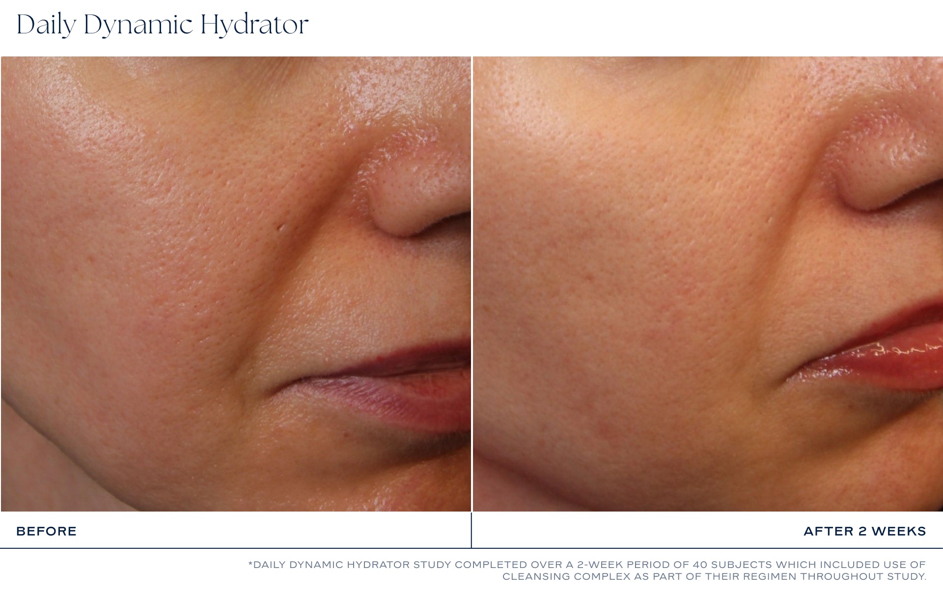 Daily Dynamic Hydrator